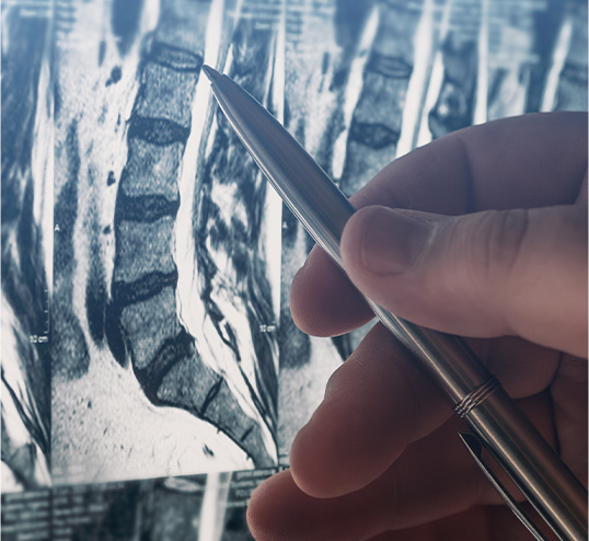 Spinal Injuries suffering from PTSD