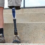 Standing man with prosthetic leg, detail