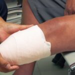 someone with an amputated leg at the doctor_s